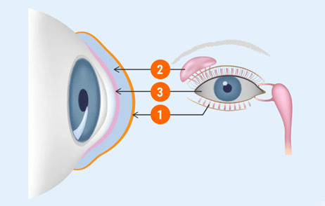 Grafik - Ursachen trockene Augen